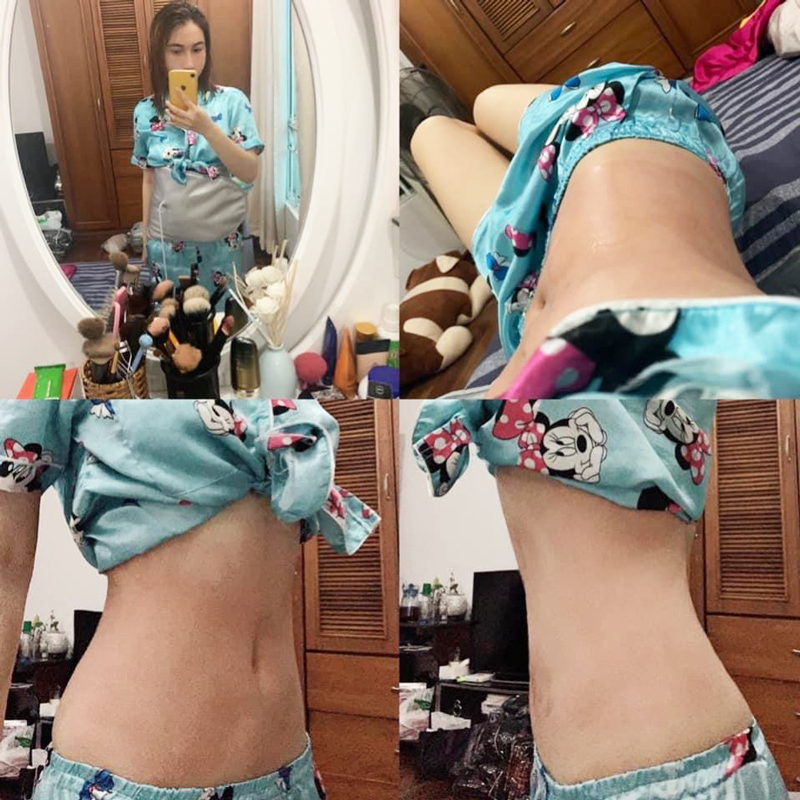 Đai Quấn Nóng Rung Massage – Làm Nóng Nhanh, Hỗ Trợ Chăm Sóc Body