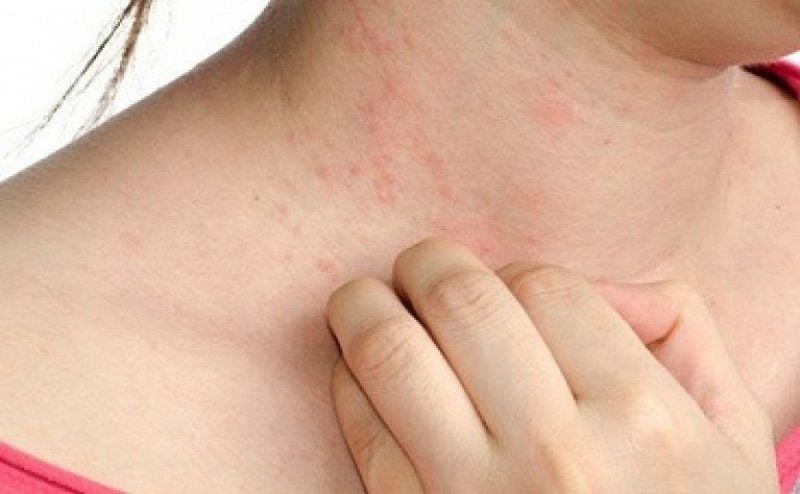 Vấn đề về da thường gặp trong ngày Hè nóng nực