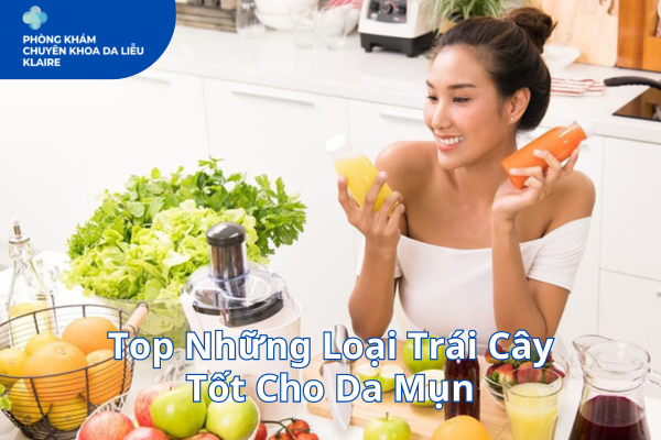 Top Những Loại Trái Cây Tốt Cho Da Mụn