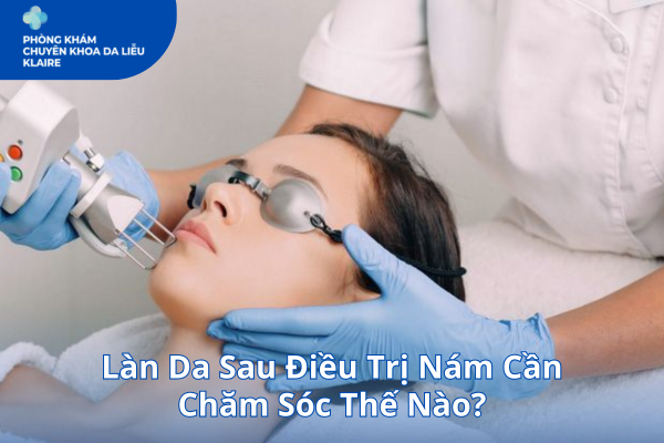 Làn Da Sau Điều Trị Nám Cần Chăm Sóc Thế Nào?