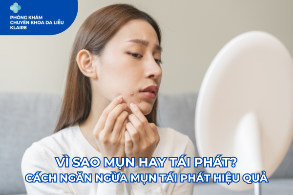 VÌ SAO MỤN HAY TÁI PHÁT? CÁCH NGĂN NGỪA MỤN TÁI PHÁT HIỆU QUẢ