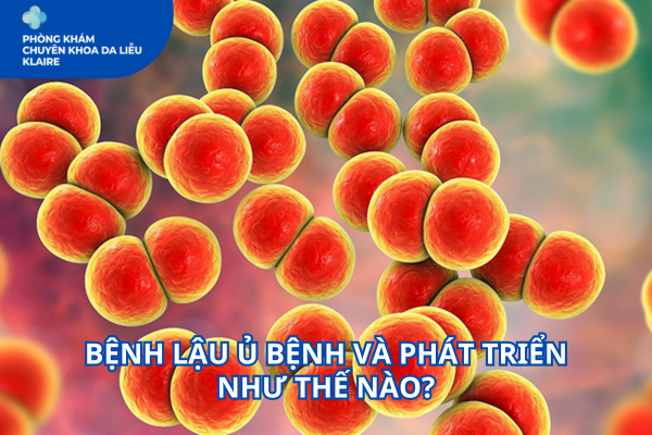BỆNH LẬU Ủ BỆNH VÀ PHÁT TRIỂN NHƯ THẾ NÀO?