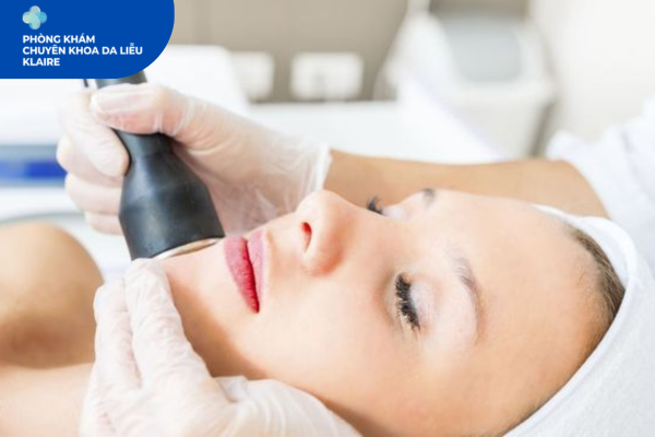 Trị Nám Chuẩn Y Khoa Klaire Clinic Hà Đông: Da Sáng Khỏe Bền Vững