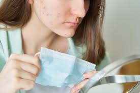 Làm thế nào để ngăn ngừa mụn khi sử dụng khẩu trang hàng ngày?