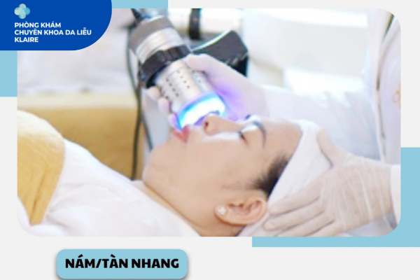 Trị Nám Tại Klaire Clinic Hà Đông: Phương Pháp Tối Ưu Cho Từng Loại Da