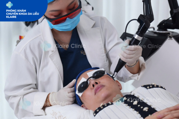Những vị trí nám da thường xuất hiện trên khuôn mặt | Điều trị nám giá rẻ tại Hà Đông