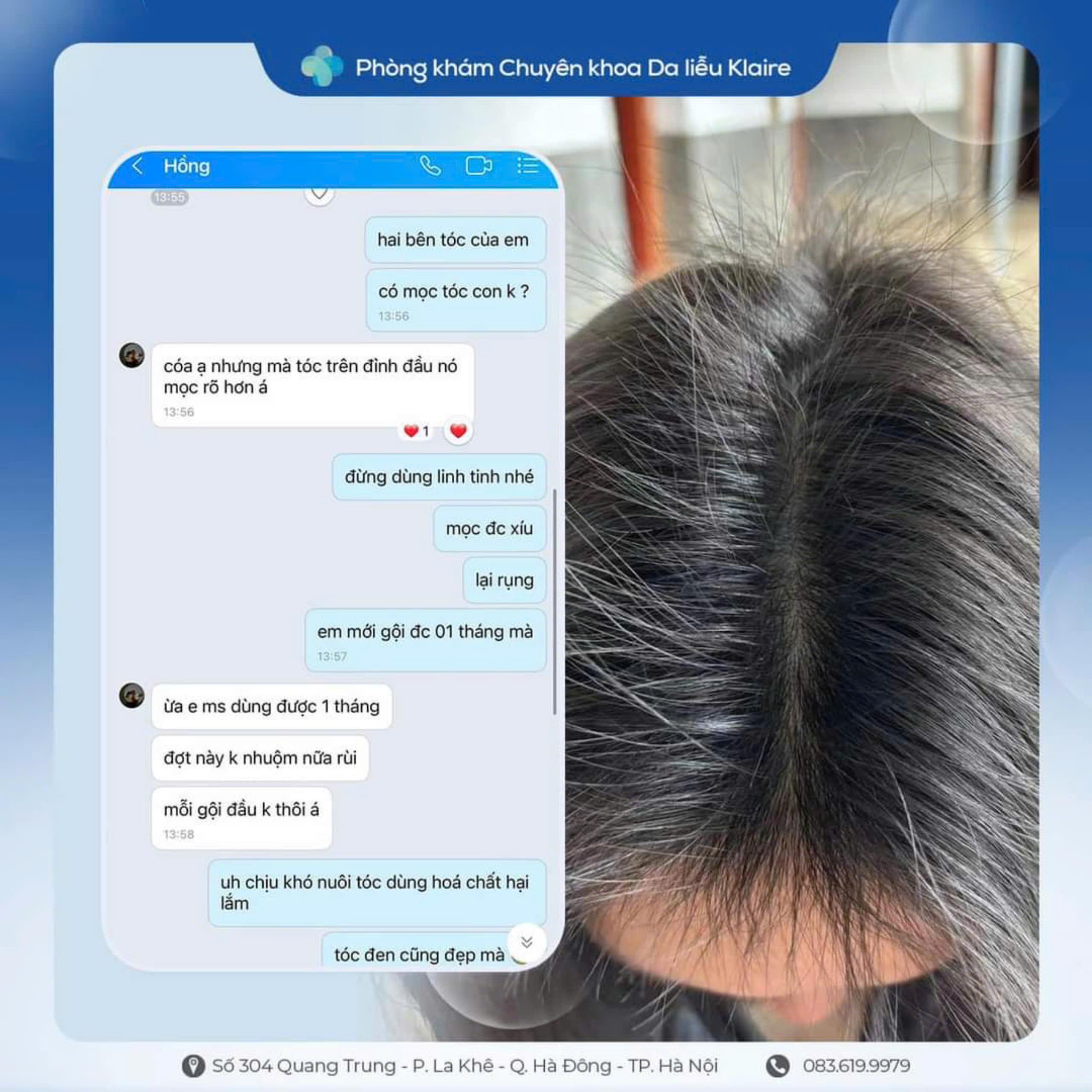 THẨM MỸ TÓC