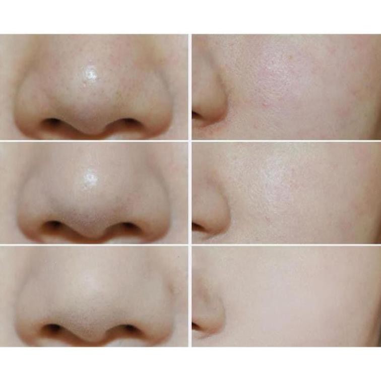 Phấn rôm kiềm dầu Shiseido Baby Powder Pressed 50gr_Nội Địa Nhật