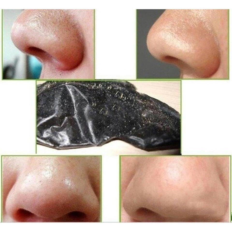 Gel lột mụn cám mũi Kose Tuýp 25g