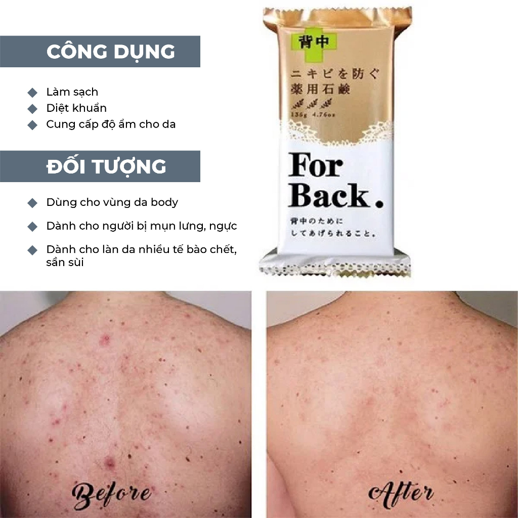 Xà Phòng trị mụn lưng For Back Nhật Bản 135g