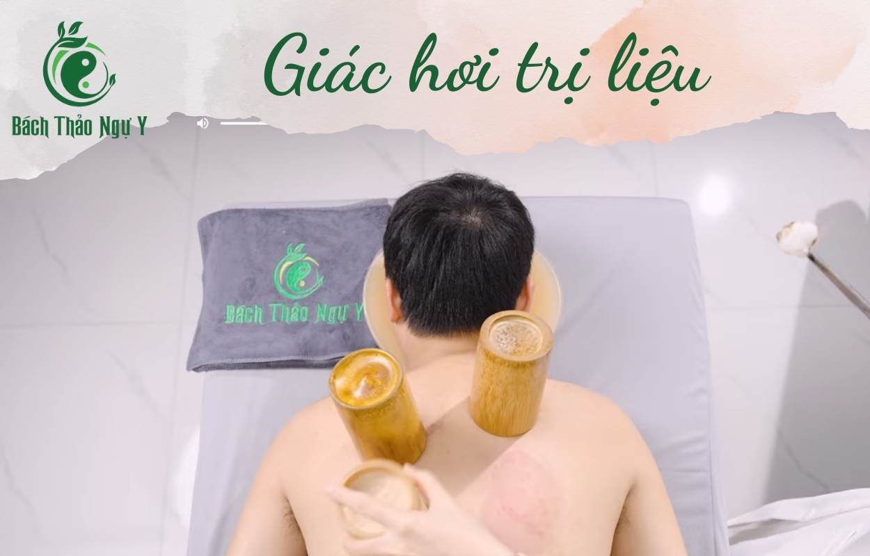 Trị liệu giác hơi