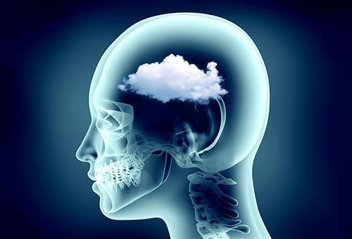 Sương Mù Não (Brain Fog): Nguyên Nhân, Triệu Chứng và Cách Khắc Phục