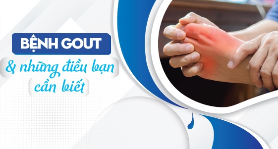 Hỗ trợ điều trị bệnh gút siêu tiết niệu: Chất bổ sung từ thảo dược tự nhiên