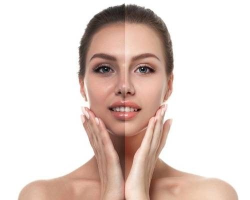 6 Loại Đồ Uống Cải Thiện Sắc Tố Da, Ngăn Ngừa Sạm Nám