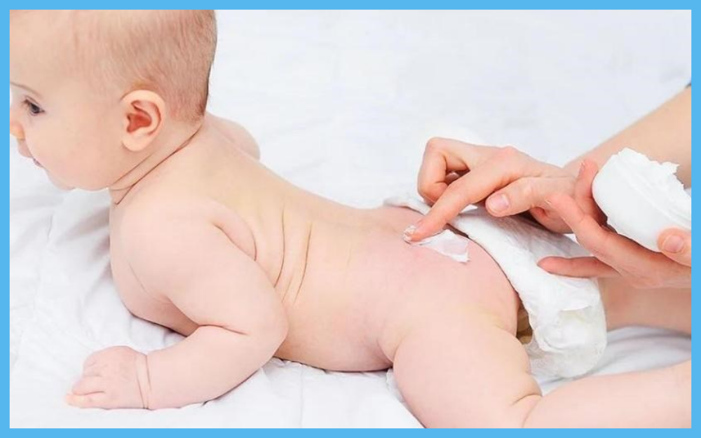 Vì sao trẻ thường bị hăm tã vào mùa đông?