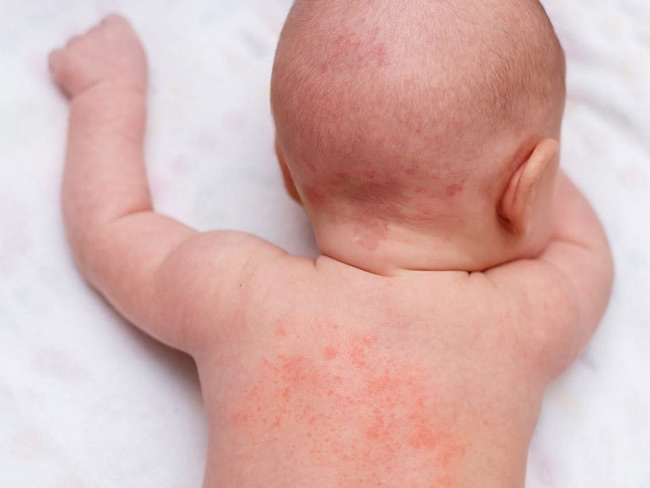 Chăm sóc da cho bé yêu khi trời hanh khô mùa thu: Những điều ba mẹ không nên bỏ qua