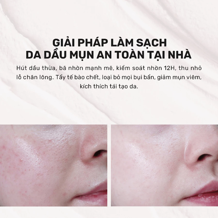 Mặt Nạ Đất Sét Hút Dầu Kiểm Soát Nhờn - Derladie Vegan Pink Clay Mask Deep Pore Tightening