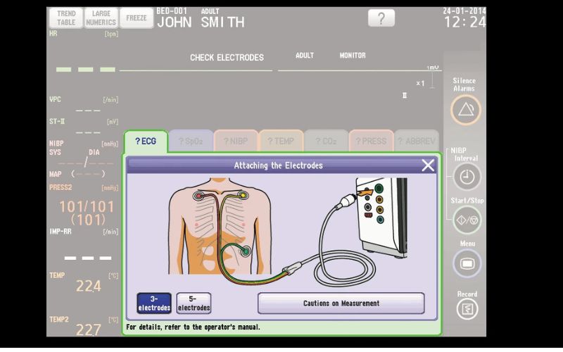 MÁY THEO DÕI BỆNH NHÂN: SVM-7600 Series Nihon Kohden