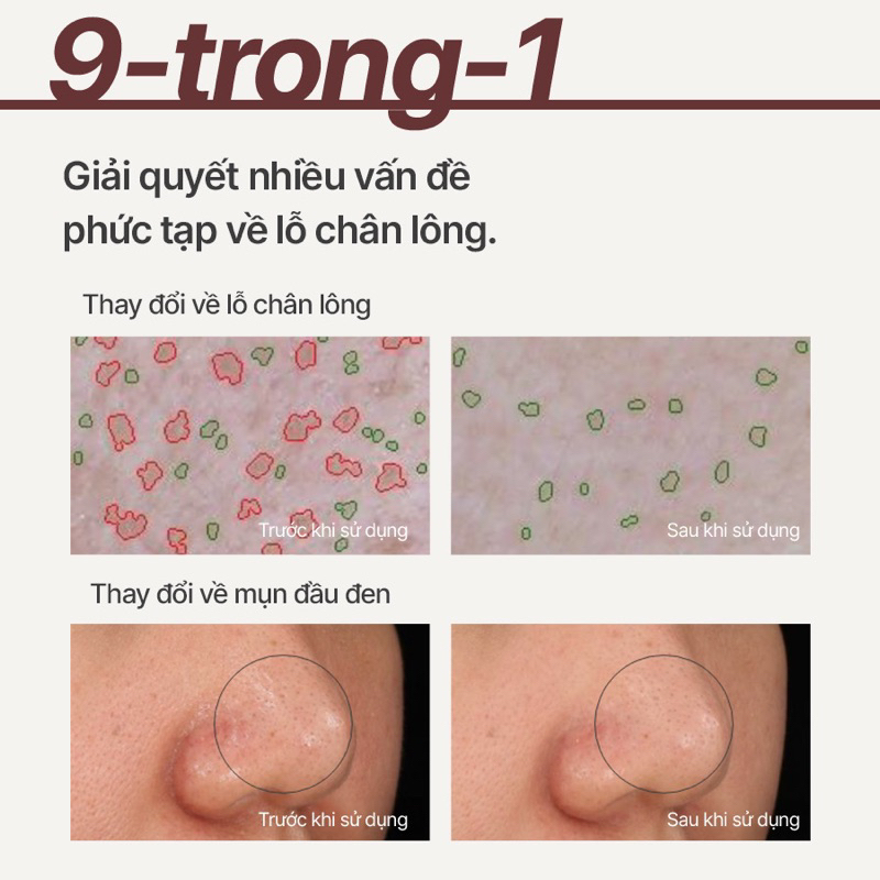 Mặt nạ đất sét Innisfree Super Volcanic Pore Clay Mask