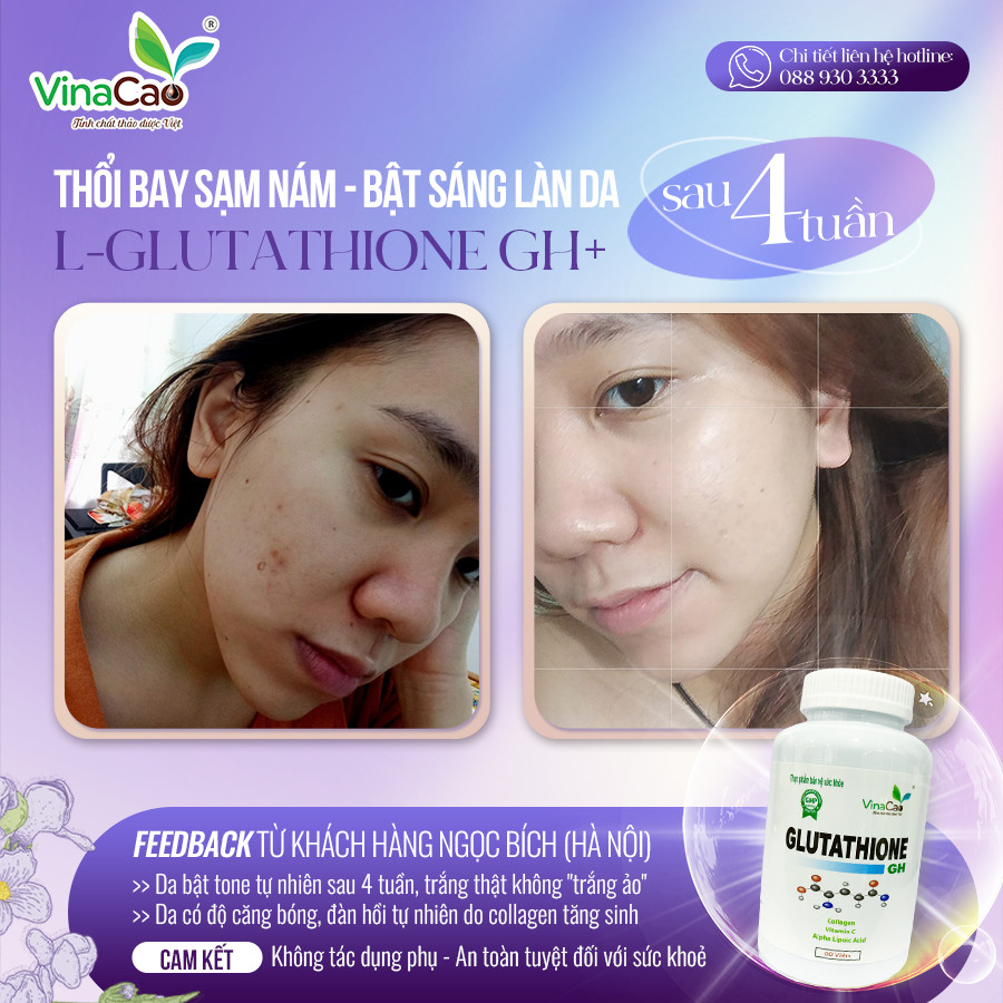 Đánh giá của Khách hàng về viên uống trắng da Glutathione Collagen GH
