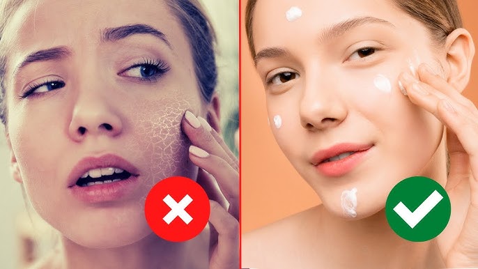 Những mẹo đơn giản giúp tạm biệt da khô vào mùa đông