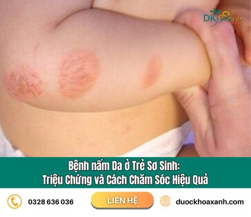 Bệnh Nấm Da Ở Trẻ Sơ Sinh: Dấu Hiệu Và Cách Chăm Sóc Hiệu Quả