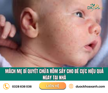MÁCH MẸ BÍ QUYẾT CHỮA RÔM SẢY CHO BÉ CỰC HIỆU QUẢ NGAY TẠI NHÀ 