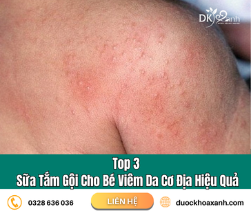 Top 3 Sữa Tắm Gội Cho Bé Viêm Da Cơ Địa Hiệu Quả