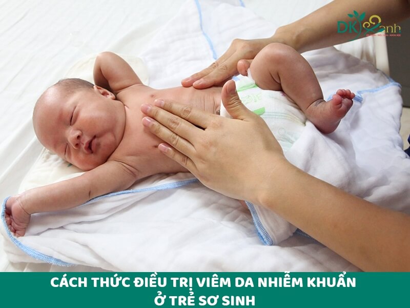 Cách thức điều trị viêm da nhiễm khuẩn ở trẻ sơ sinh