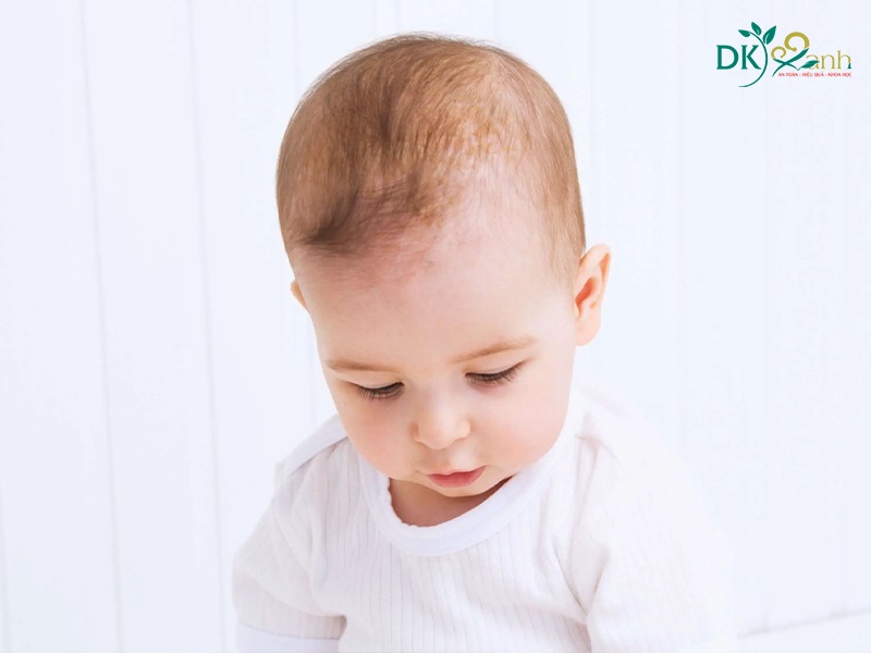 cứt trâu ở trẻ sơ sinh là gì