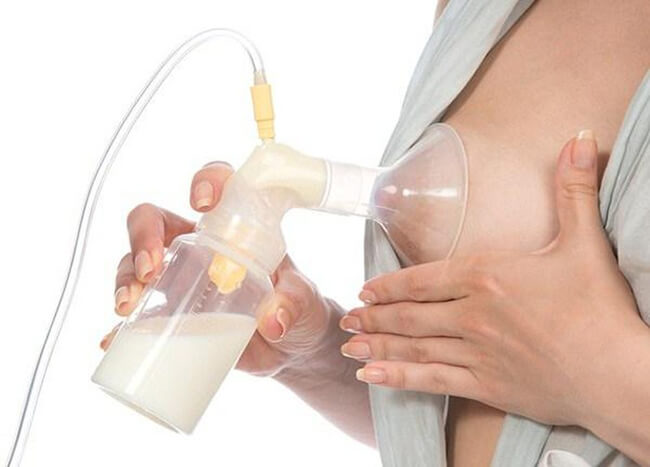 Hút sữa có thể điều trị được tắc tia sữa ở giai đoạn sớm