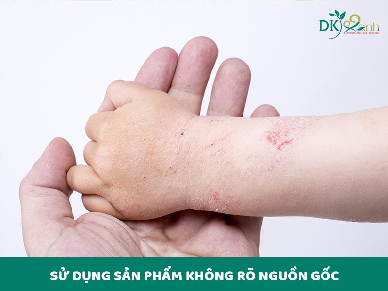 Sử dụng sản phẩm không rõ nguồn gốc