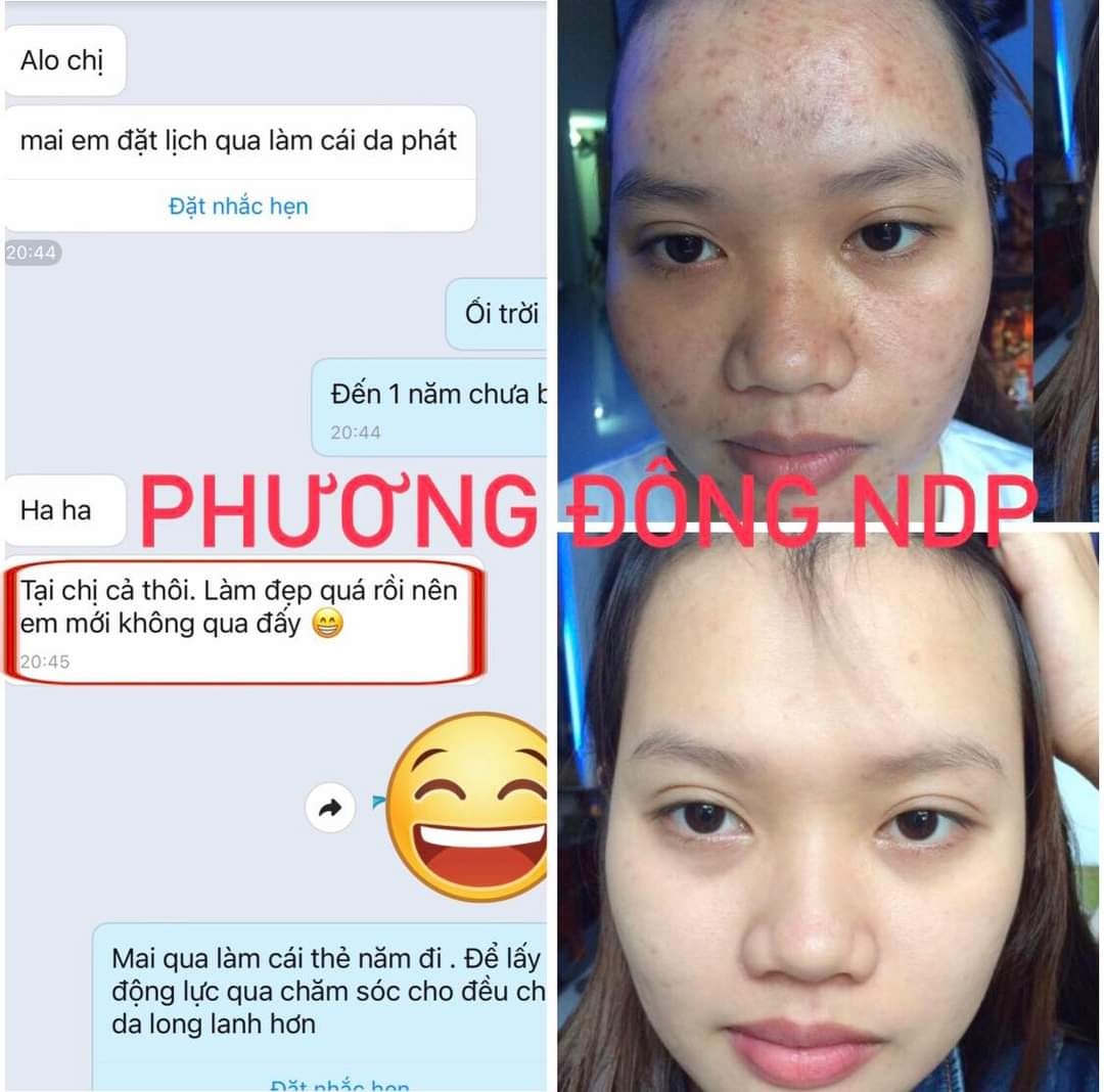 Nhiều bạn hỏi cách trị mụn nên mình xin chia sẻ một số điểm cần lưu ý trong Quá Trình điều trị mụn luôn nhé: