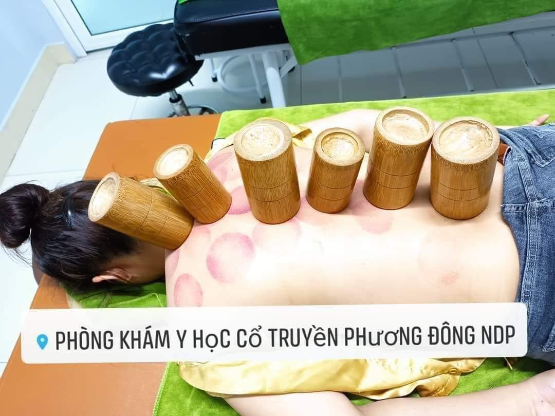 TÁC DỤNG PHƯƠNG PHÁP GIÁC HƠI