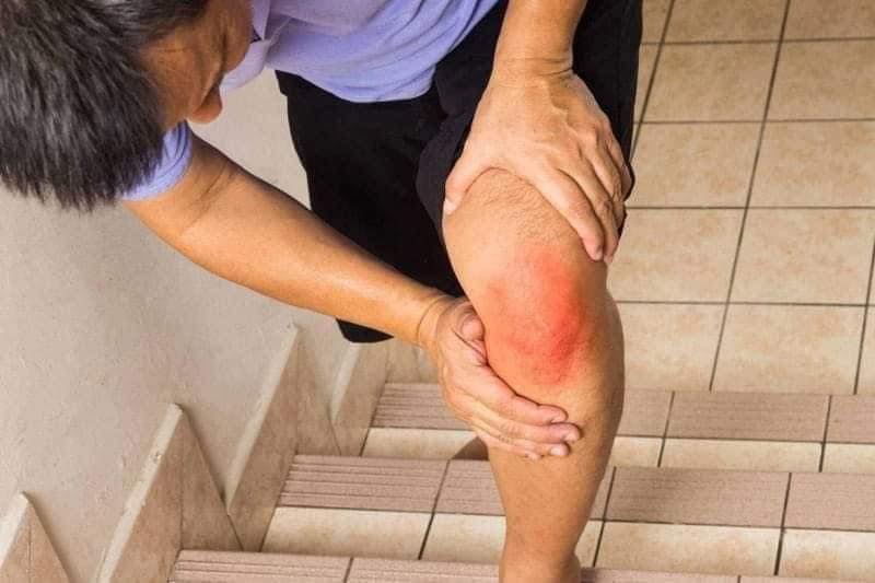 THOÁI HOÁ KHỚP GỐI