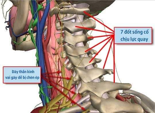 ĐAU VAI GÁY - NỖI LO CỦA DÂN VĂN PHÒNG