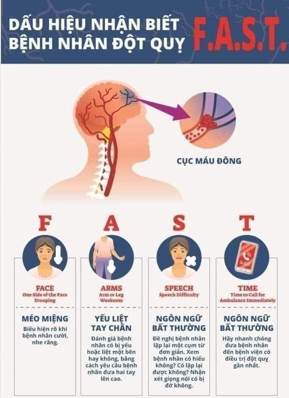 Tại sao đột quỵ lại hay xảy ra vào sáng sớm?