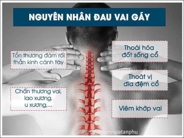 ĐAU CỔ VAI GÁY .... KHÔNG CHỮA BÂY GIỜ THÌ BAO GIỜ?