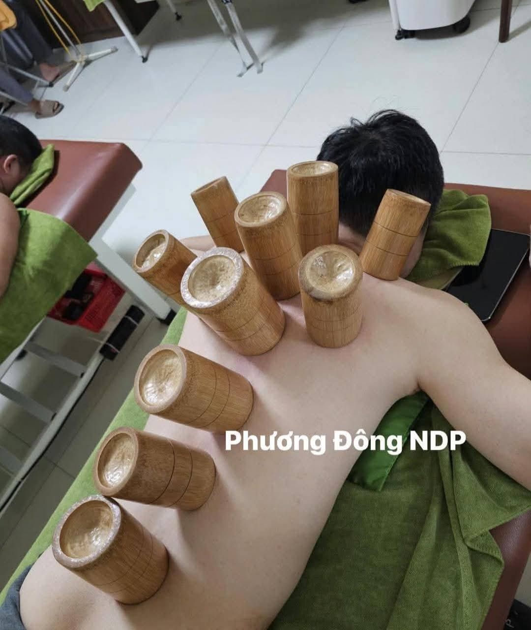 TÁC DỤNG PHƯƠNG PHÁP GIÁC HƠI