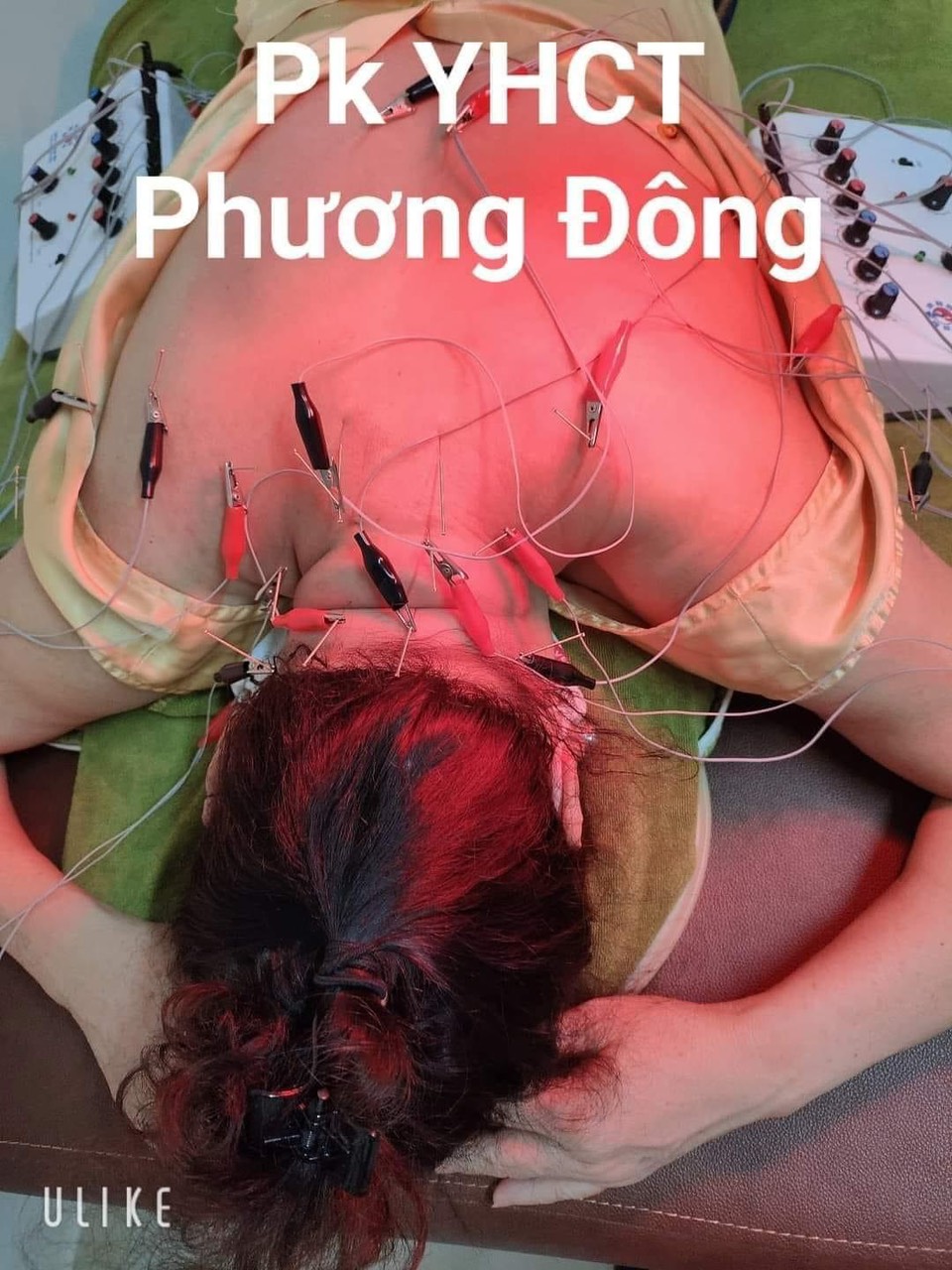MẤT NGỦ - ĐIỀU TRỊ NHƯ THẾ NÀO ĐỂ ĐẠT HIỆU QUẢ