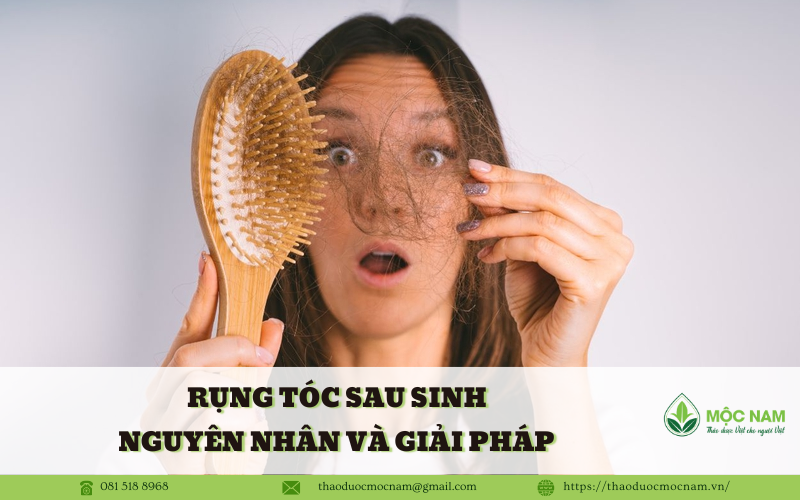 Rụng tóc sau sinh nguyên nhân và giải pháp 