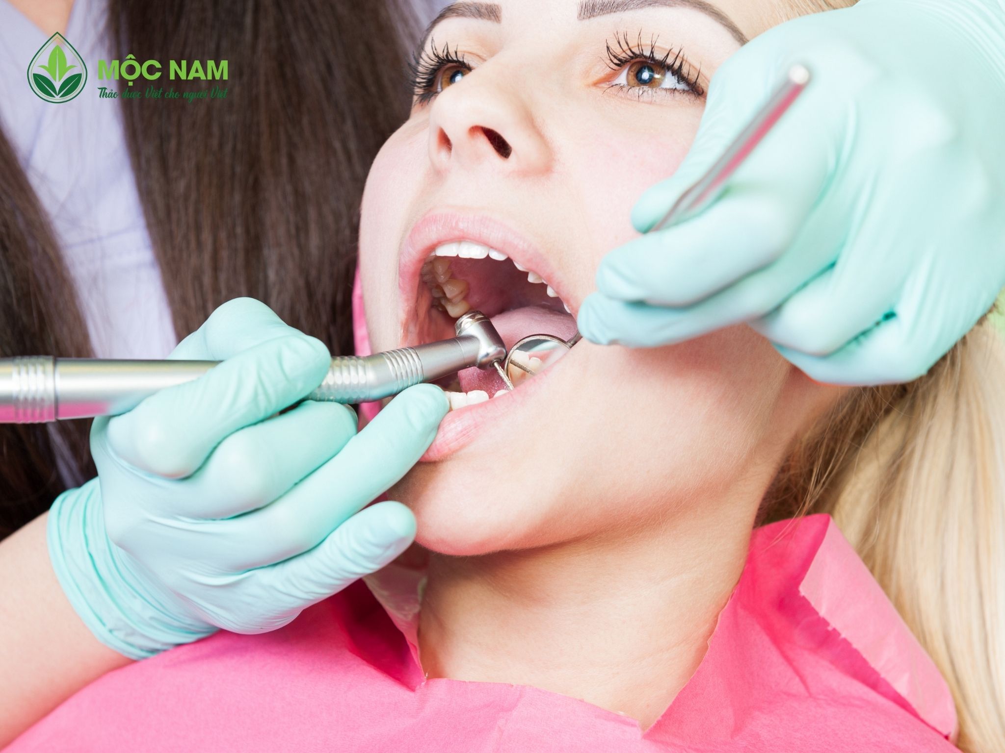 5 điều lưu ý khi lấy cao răng để bảo vệ răng miệng khỏe mạnh
