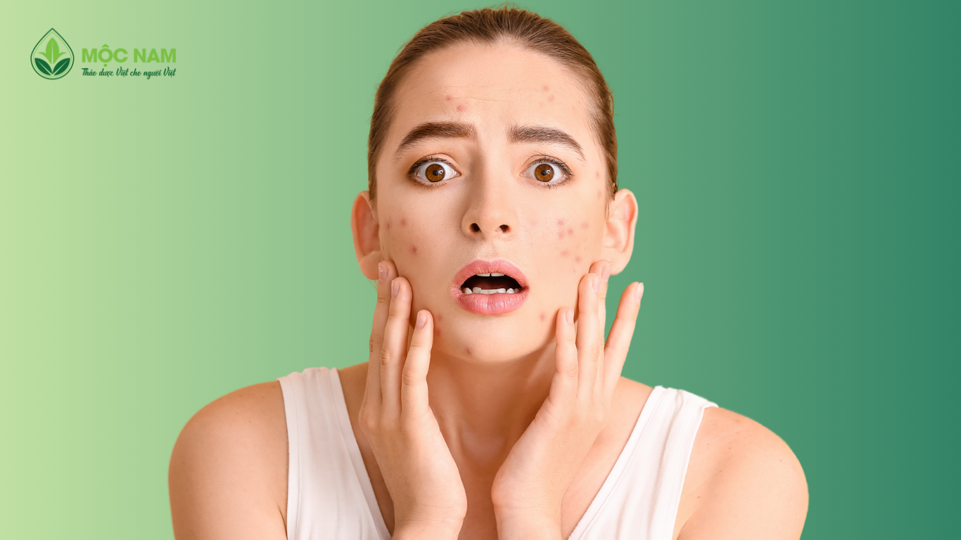 Vỡ lẽ sai lầm khiến da nổi mụn dù đã rửa mặt rất kỹ