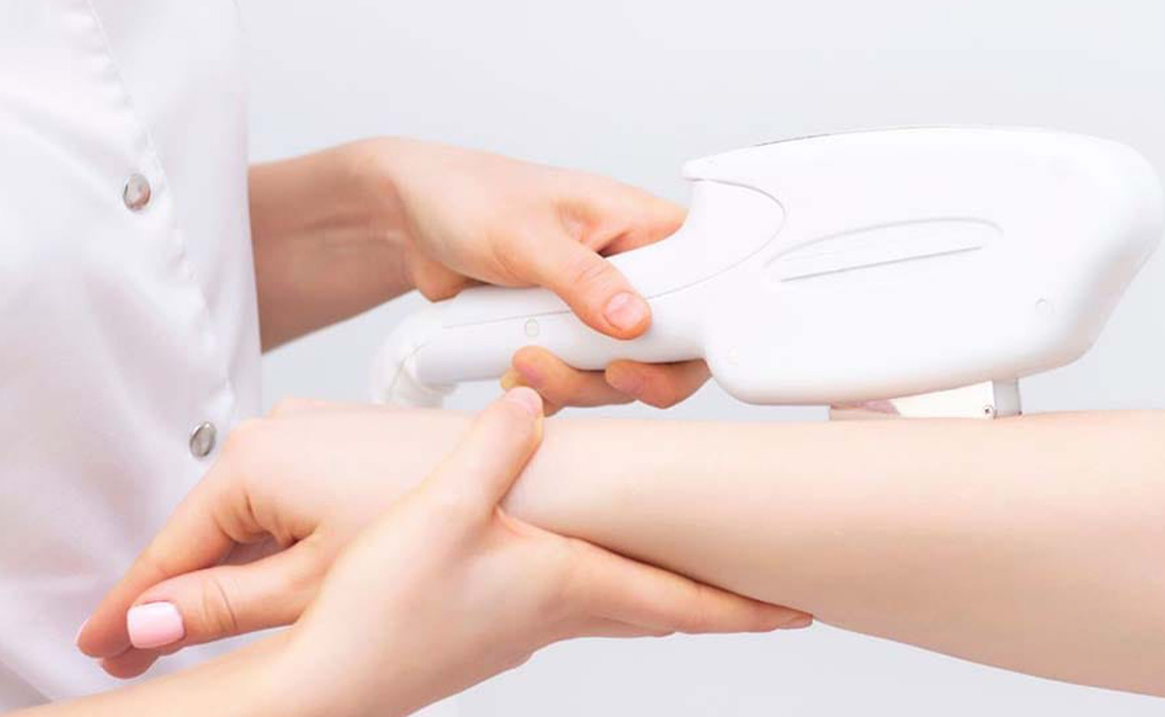 Cách triệt lông ở ngón tay giúp bàn tay mềm mịn cực xinh