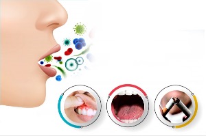 Làm thế nào HomoSAN giúp kiểm soát hôi miệng và viêm khoang miệng