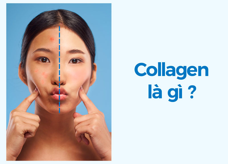 Collagen là gì?