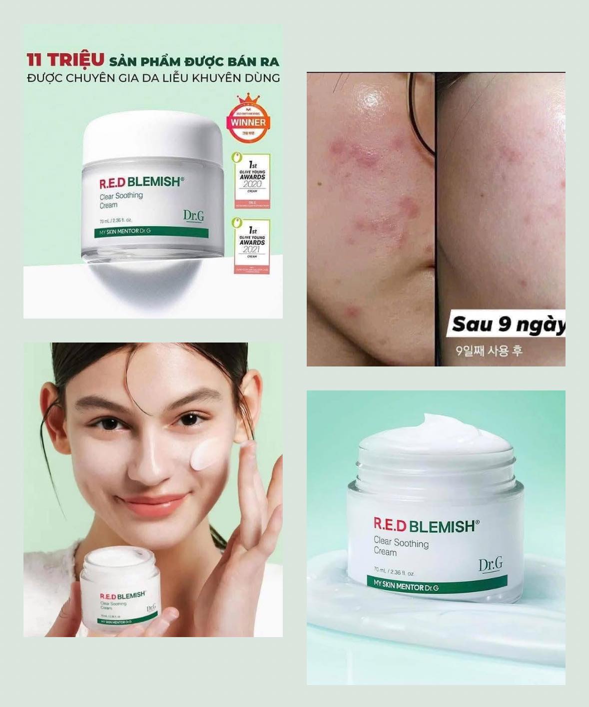Kem 𝐃𝐑.𝐆 𝐑.𝐄.𝐃 𝐁𝐋𝐄𝐌𝐈𝐒𝐇 𝐂𝐋𝐄𝐀𝐑 𝐒𝐎𝐎𝐓𝐇𝐈𝐍𝐆 𝐂𝐑𝐄𝐀𝐌 da mụn