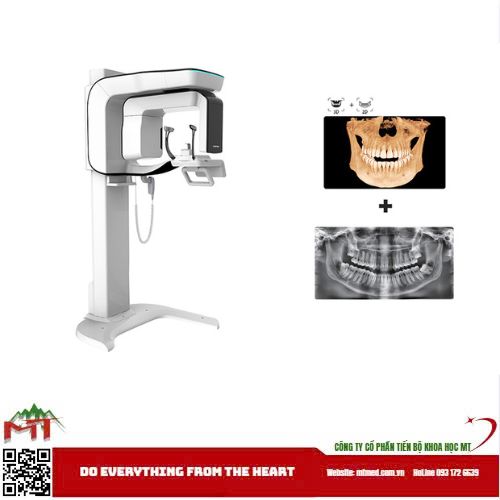 Máy X-quang Nha Khoa – Giải Pháp Tối Ưu Cho Việc Chẩn Đoán Và Điều Trị Sớm