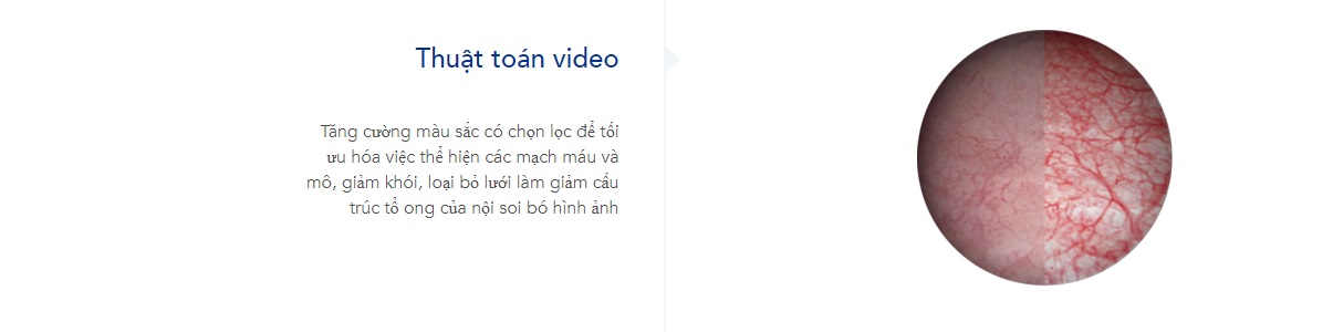 hình ảnh nội soi