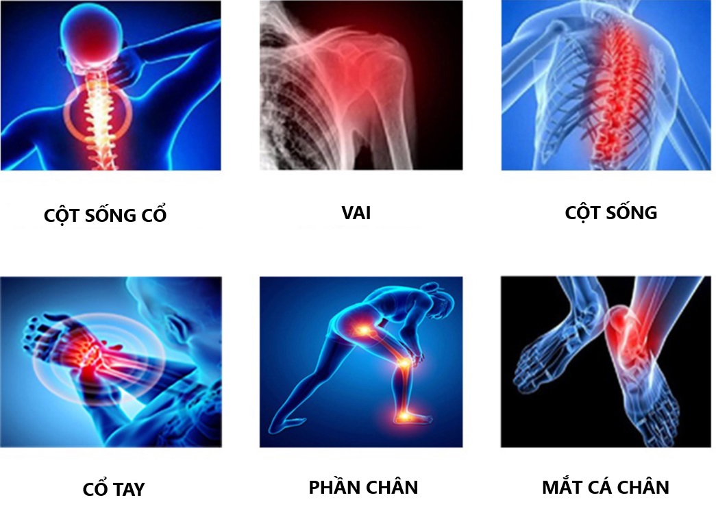 các vùng trị liệu trên cơ thể bệnh nhân